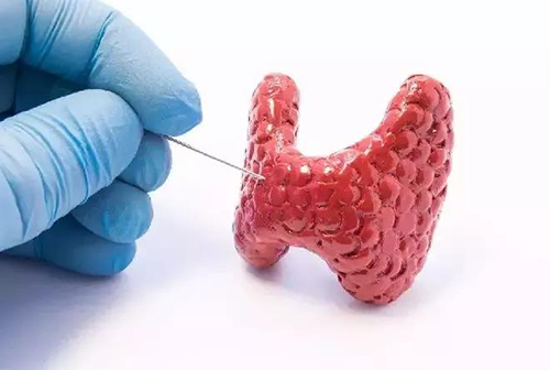 甲状腺疾病，包括甲状腺功能减退和甲状腺功能亢进，自古以来就是反复被医学研究人员研究的疾病