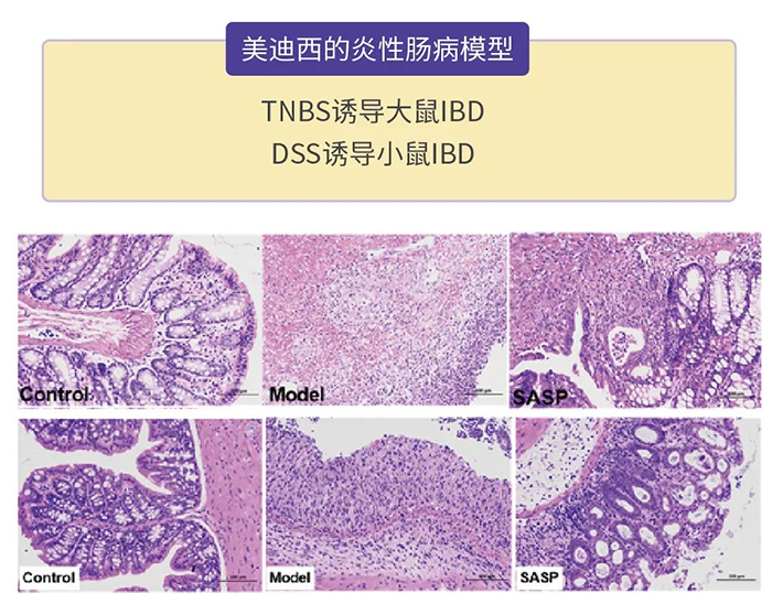 K8官网的炎性肠病模型.png